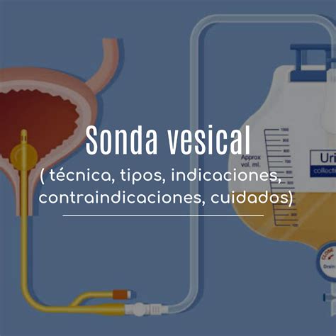 Colocación de Sonda vesical en mujer